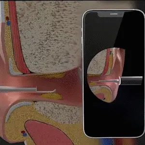 slide image